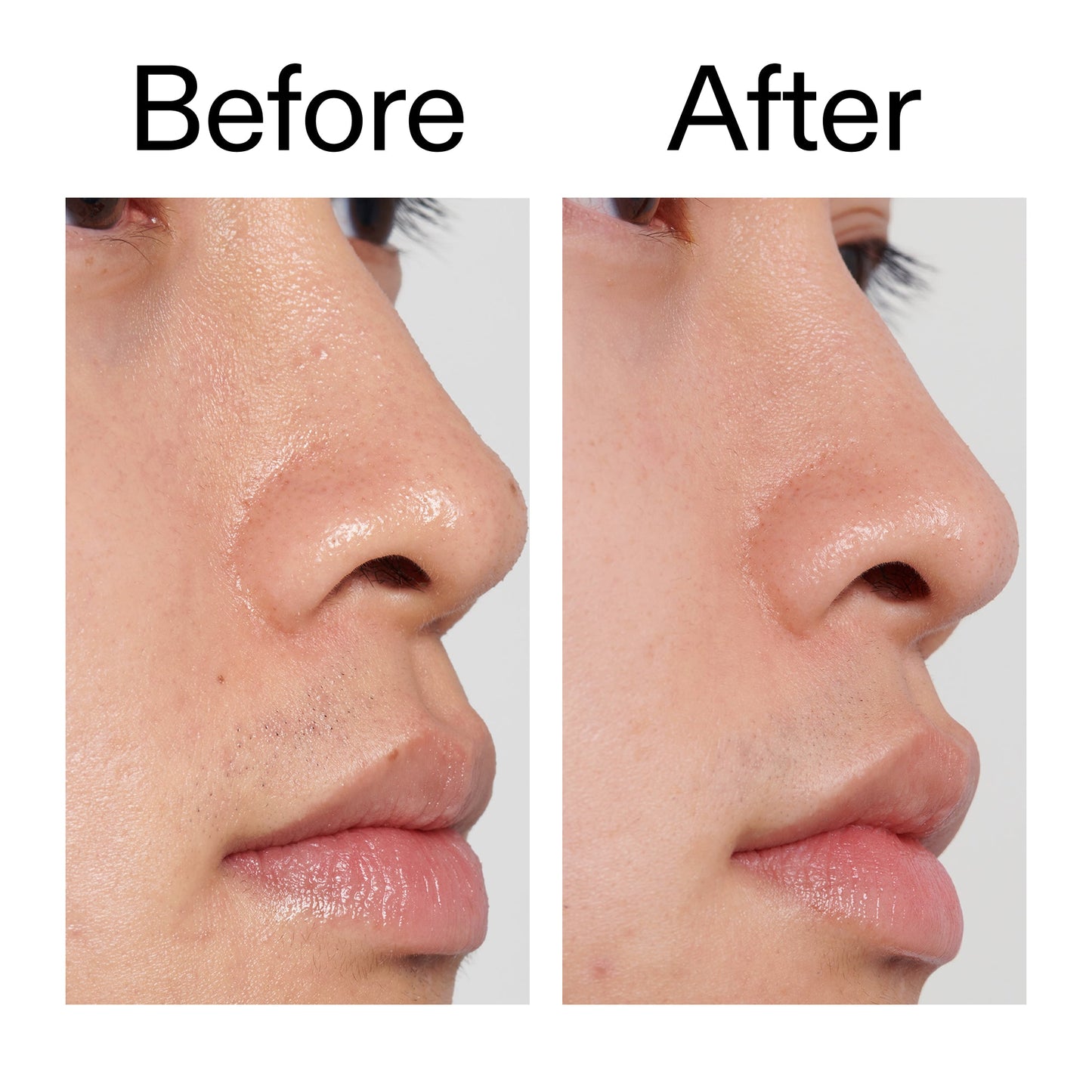 pha-toner-k2 PHA_Toner_Before_After_2000x2000_e3c10172-0150-4342-8b95-57417eaff50d.jpg