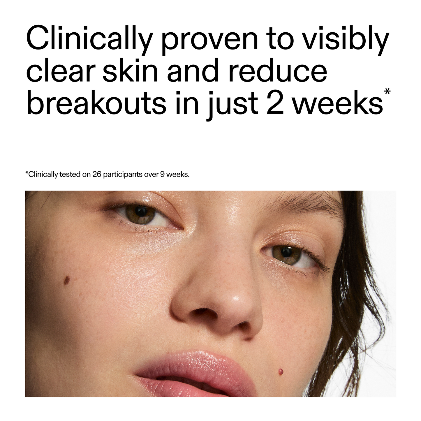 360-acne-clearing-serum-k1 360_Serum_Key_Claim.png
