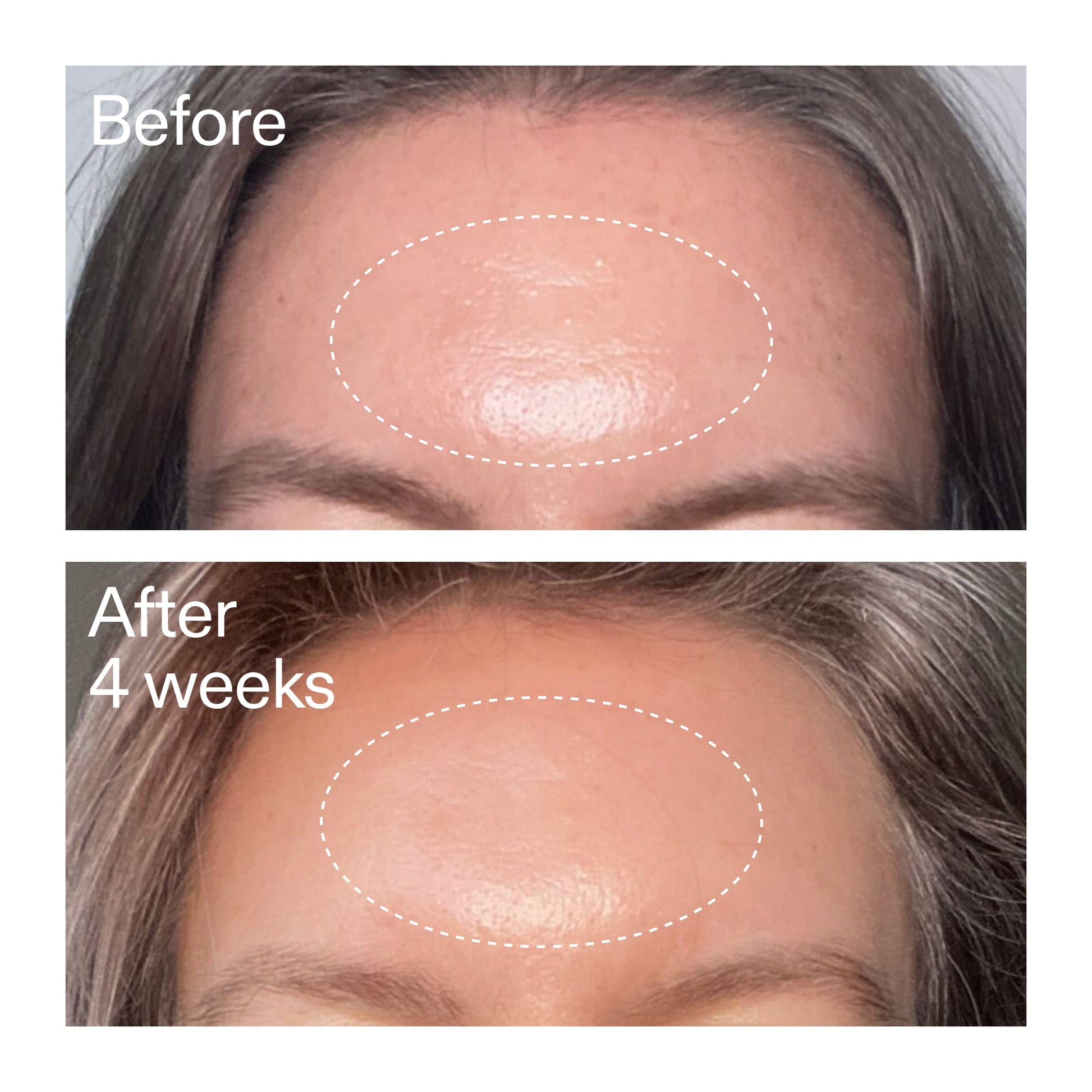 advanced-0-2-retinal-serum-duo-b7 AdvancedRetinal_BeforeAfter1_2000x2000_4e9c798a-f30e-45b8-a34a-7c4740f2f2cb.jpg