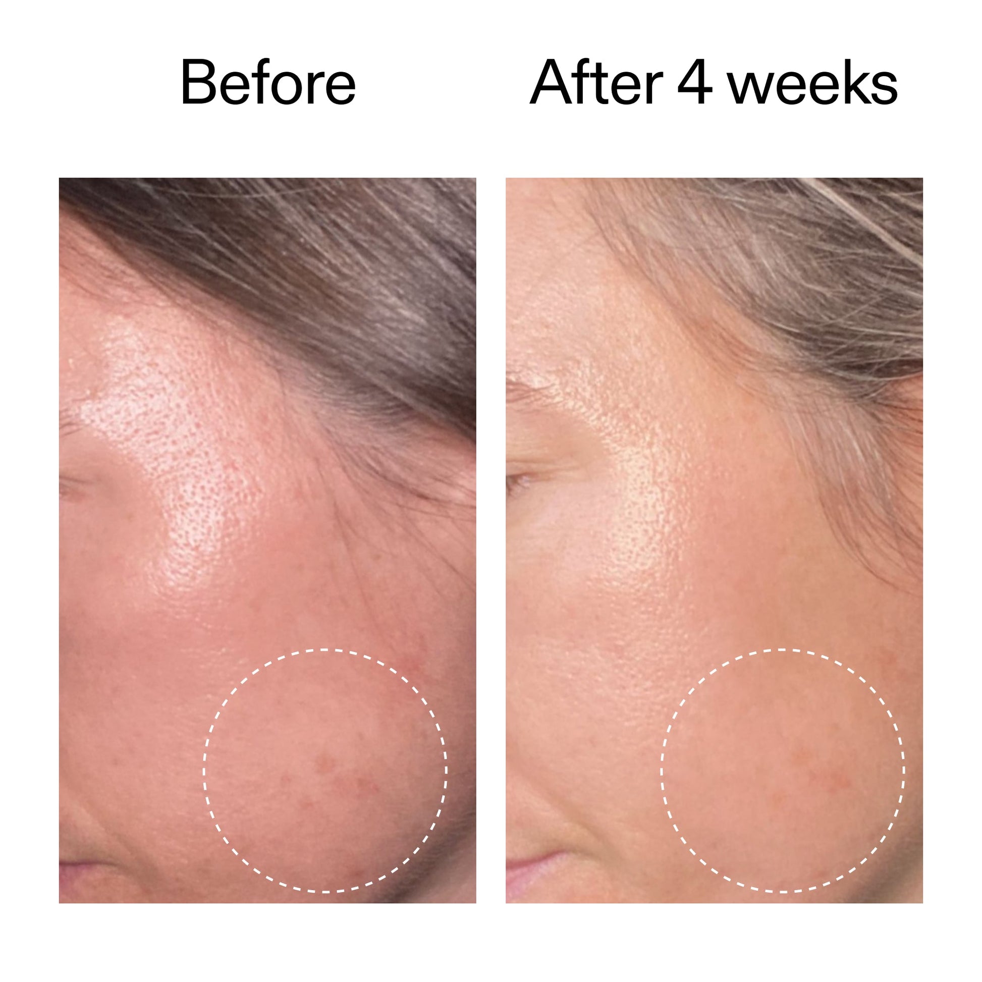 advanced-0-2-retinal-serum-l6 AdvancedRetinal_BeforeAfter2__2000x2000_62fb16bb-77ae-4d63-8500-88dbf847f4b9.jpg