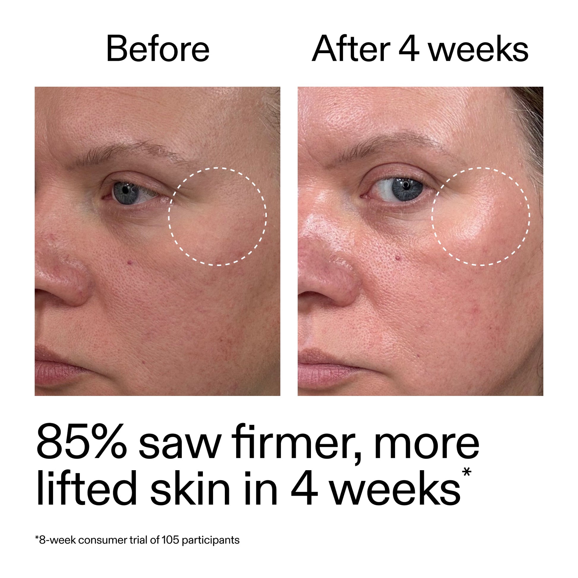 advanced-0-2-retinal-serum-l6 AdvancedRetinal_BeforeAfter_Claim1_2000x2000_bcc385c4-5e73-4f1e-aba8-64267937d0d3.jpg