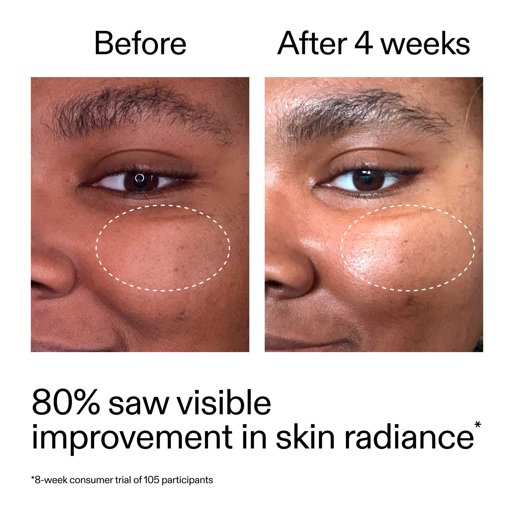 advanced-0-2-retinal-serum-l6 AdvancedRetinal_BeforeAfter_Claim2_2000x2000_39d11e3d-eda9-44ec-ab32-2903b1a368bd.jpg