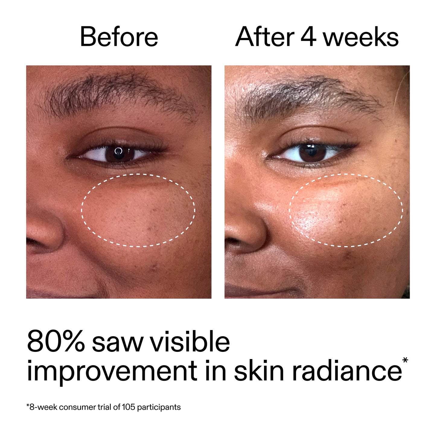 advanced-0-2-retinal-serum-duo-b7 AdvancedRetinal_BeforeAfter_Claim2_2000x2000_681b621d-8d44-4d44-9a40-89244f9b2e53.jpg