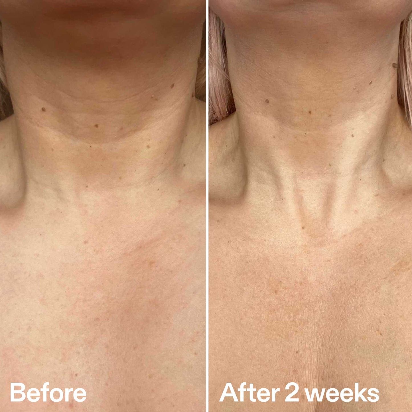 bio-active-neck-lift-stick-n7 B_A_2.jpg