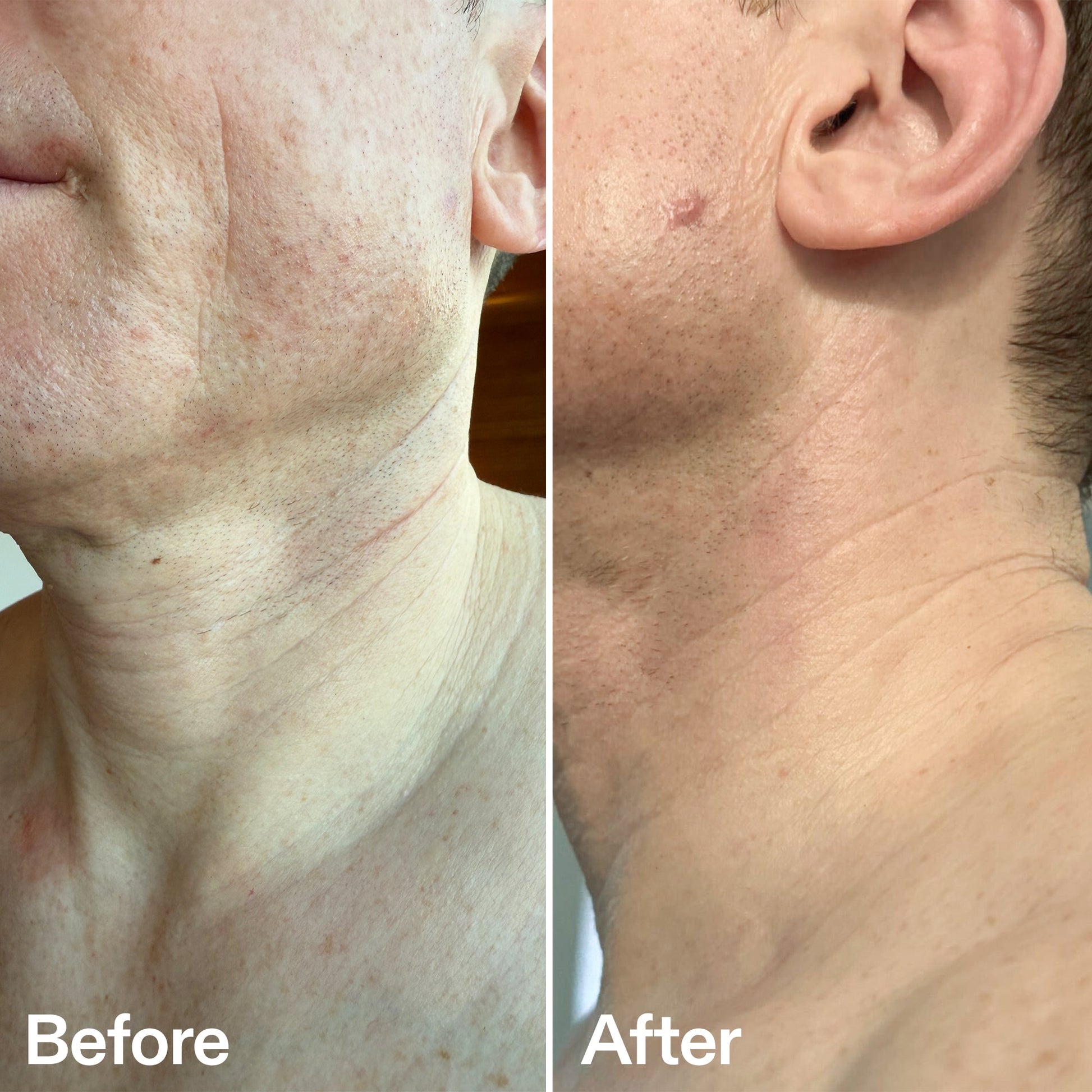 bio-active-neck-lift-stick-n7 B_A_afa2743e-b8e2-4504-92f4-e281cb6cf759.jpg