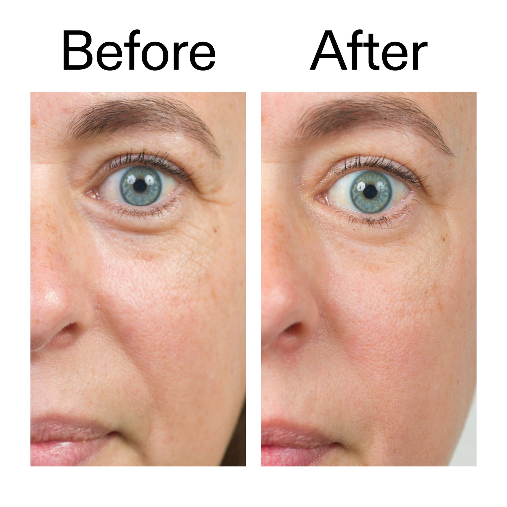 bio-active-ceramide-moisturizer-c1 Bio-Active_Before_After_2000x2000_566e5a9e-135e-417a-8242-b44e5fa35463.jpg