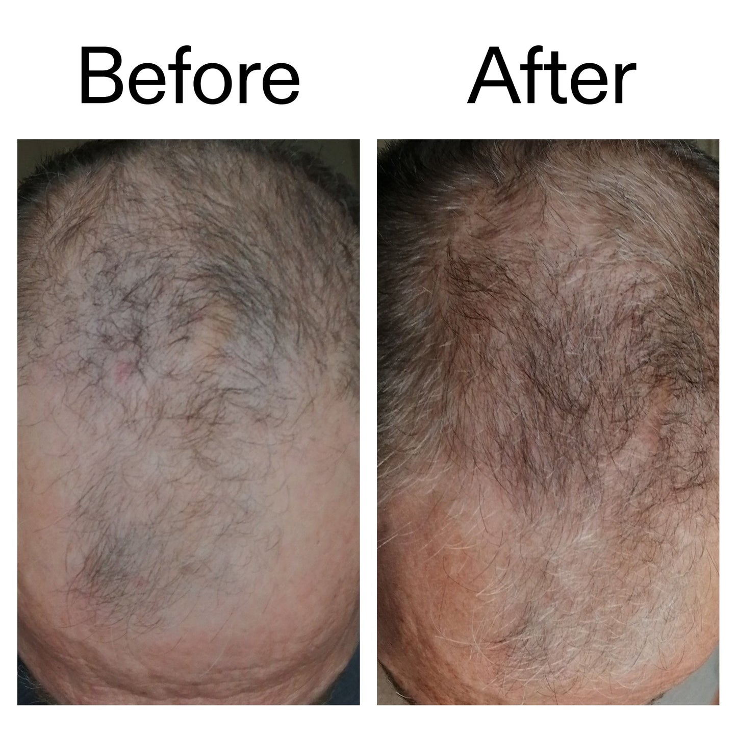 caffeine-stimulating-scalp-treatment-r3 Caffeine_Scalp_Treatment_B_A_Ppage_2000_x_2000.jpg