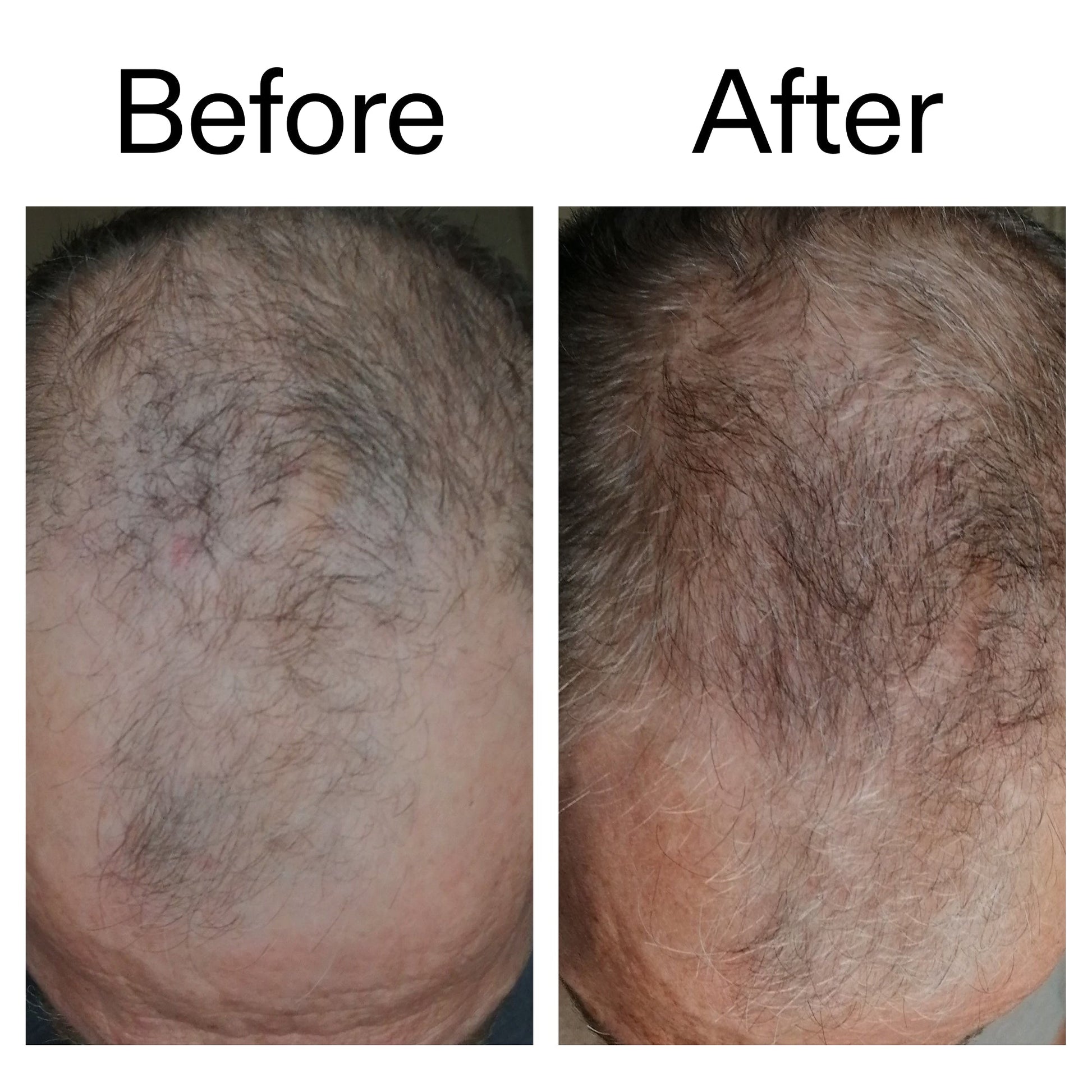 caffeine-stimulating-scalp-treatment-r3 Caffeine_Scalp_Treatment_B_A_Ppage_2000_x_2000.jpg