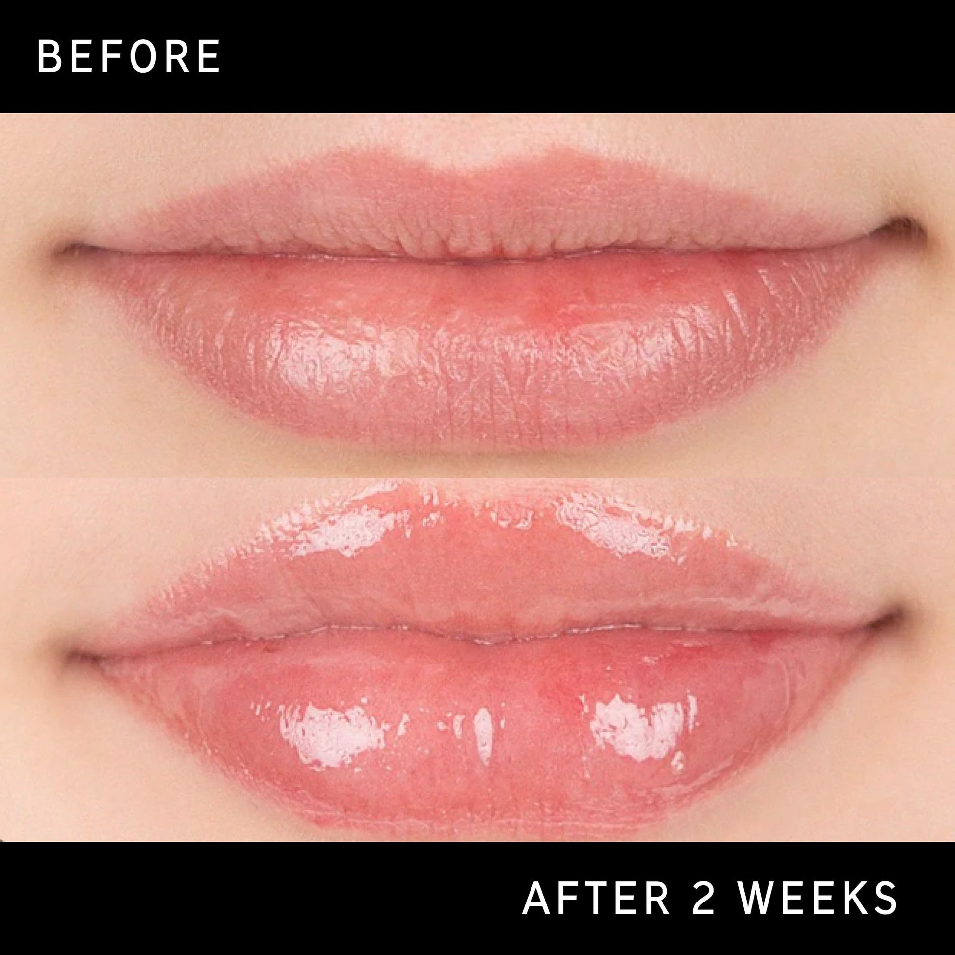 lip-plumping-duo-y1 DTC-Top15_Amends_Tripeptide-Lip_B_A.jpg
