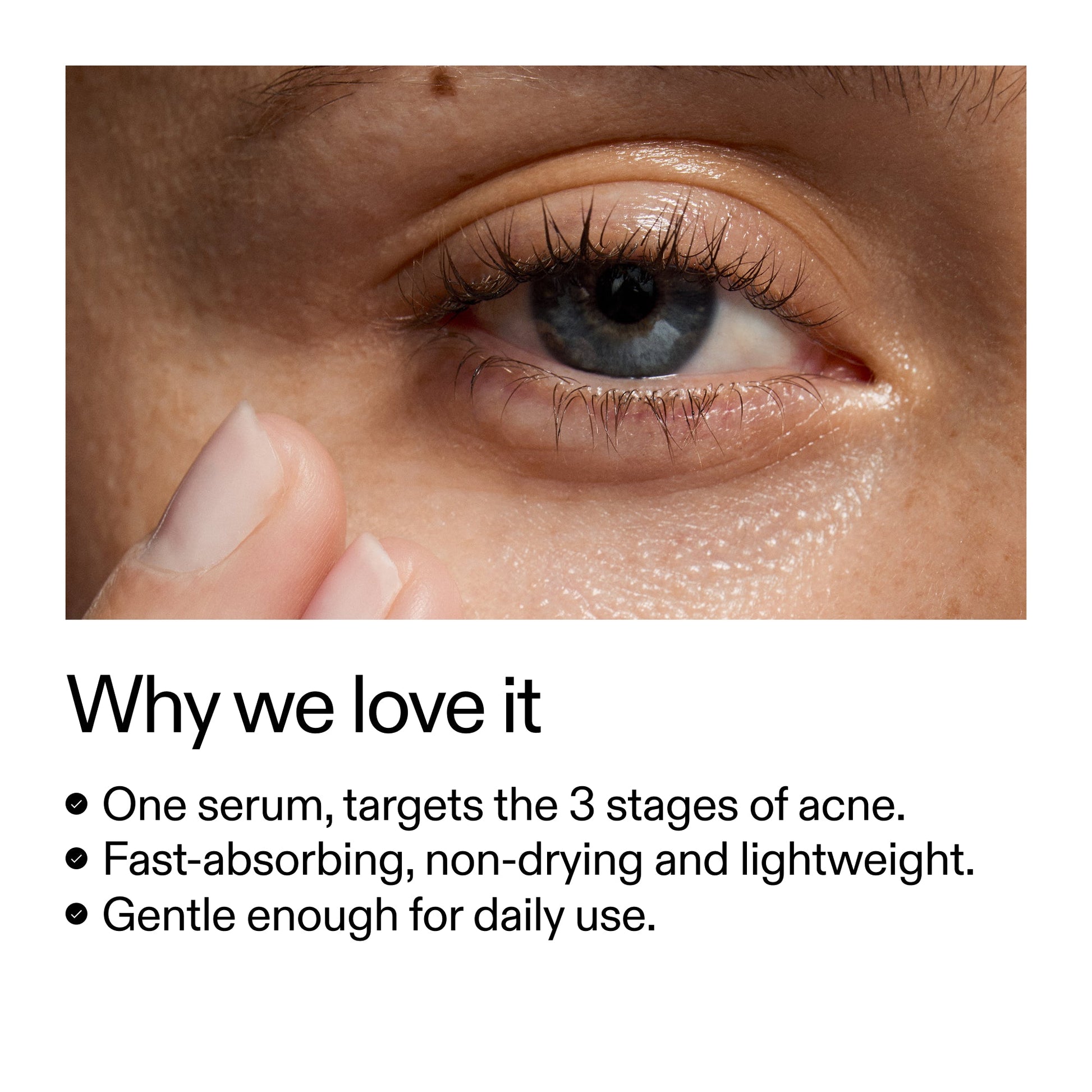 360-acne-clearing-duo-t2 Dioic_Whyweloveit_2000x2000_175aafd3-0cbe-403a-b317-a8362881bfe2.jpg