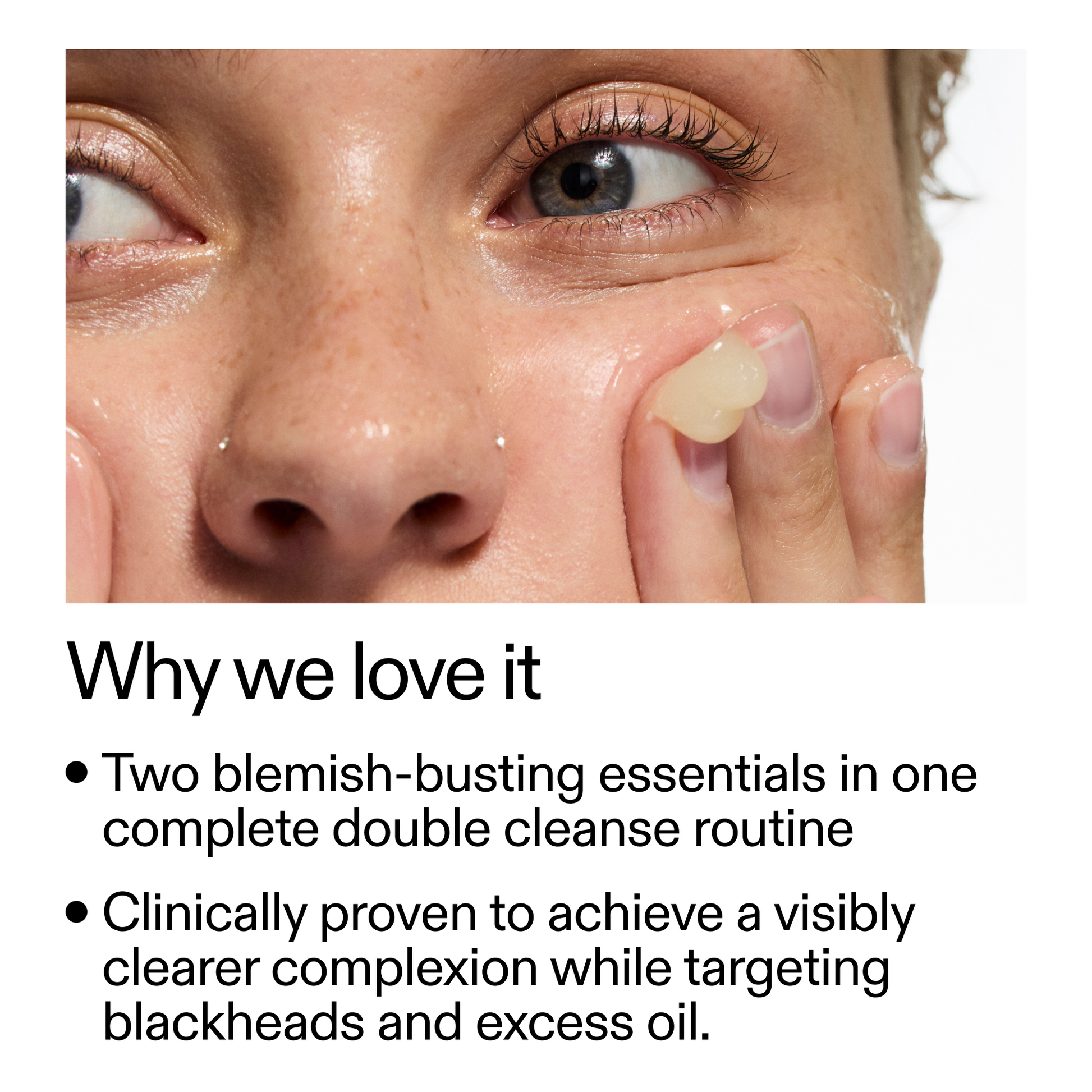 acne-double-cleanse-duo-d0 Double_Cleanse_Duo_for_Breakouts_Why_We_2000x2000_f242cb12-bb5c-487c-b203-071ccb406ec5.png