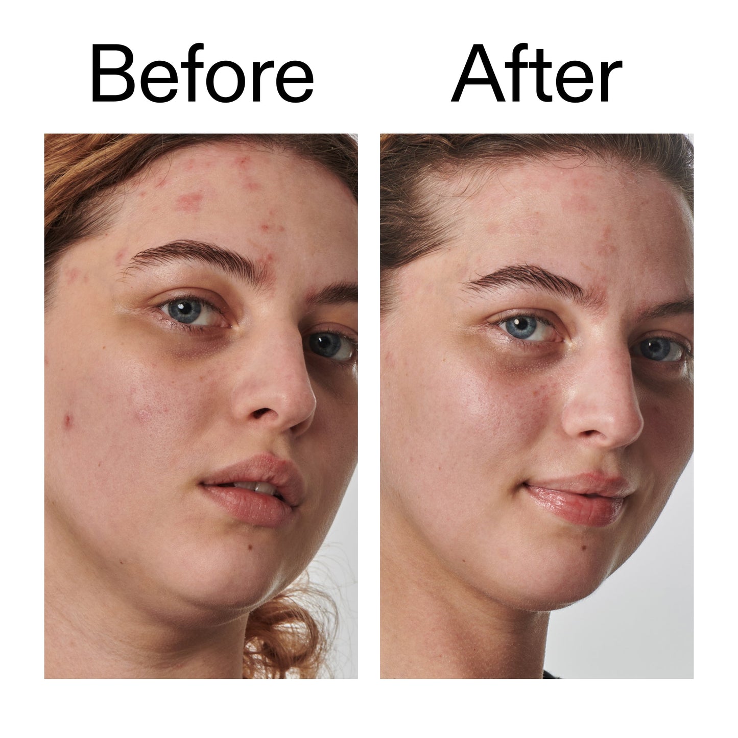 10-urea-moisturizer-i5 Dry_and_Rough_Skin_Solution_Before_After_2000x2000_efa6e639-5c39-49bd-a5dd-f0220293120a.jpg