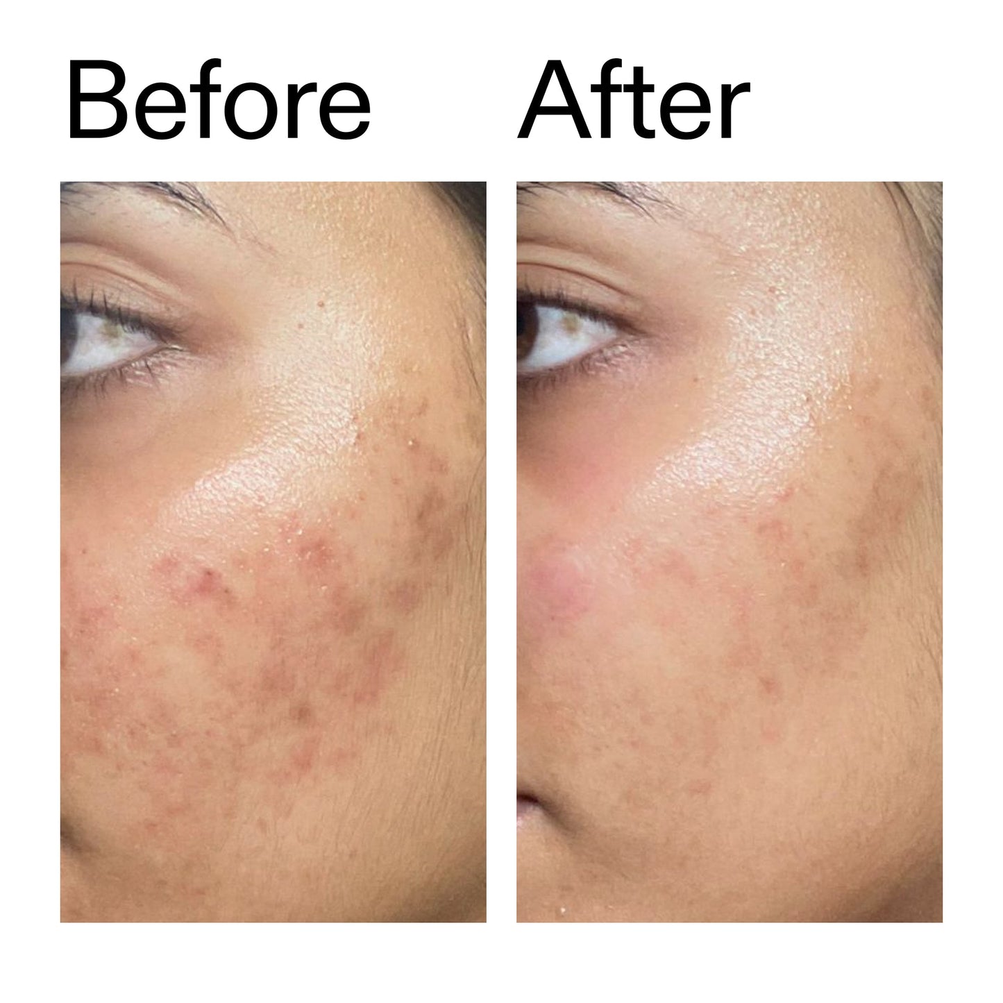 ectoin-hydro-barrier-serum-l8 Ectoin_Hydro-barrier_Serum__Before_After_2000x2000_34261920-d004-48d0-9c7b-8e1c15971bfd.jpg