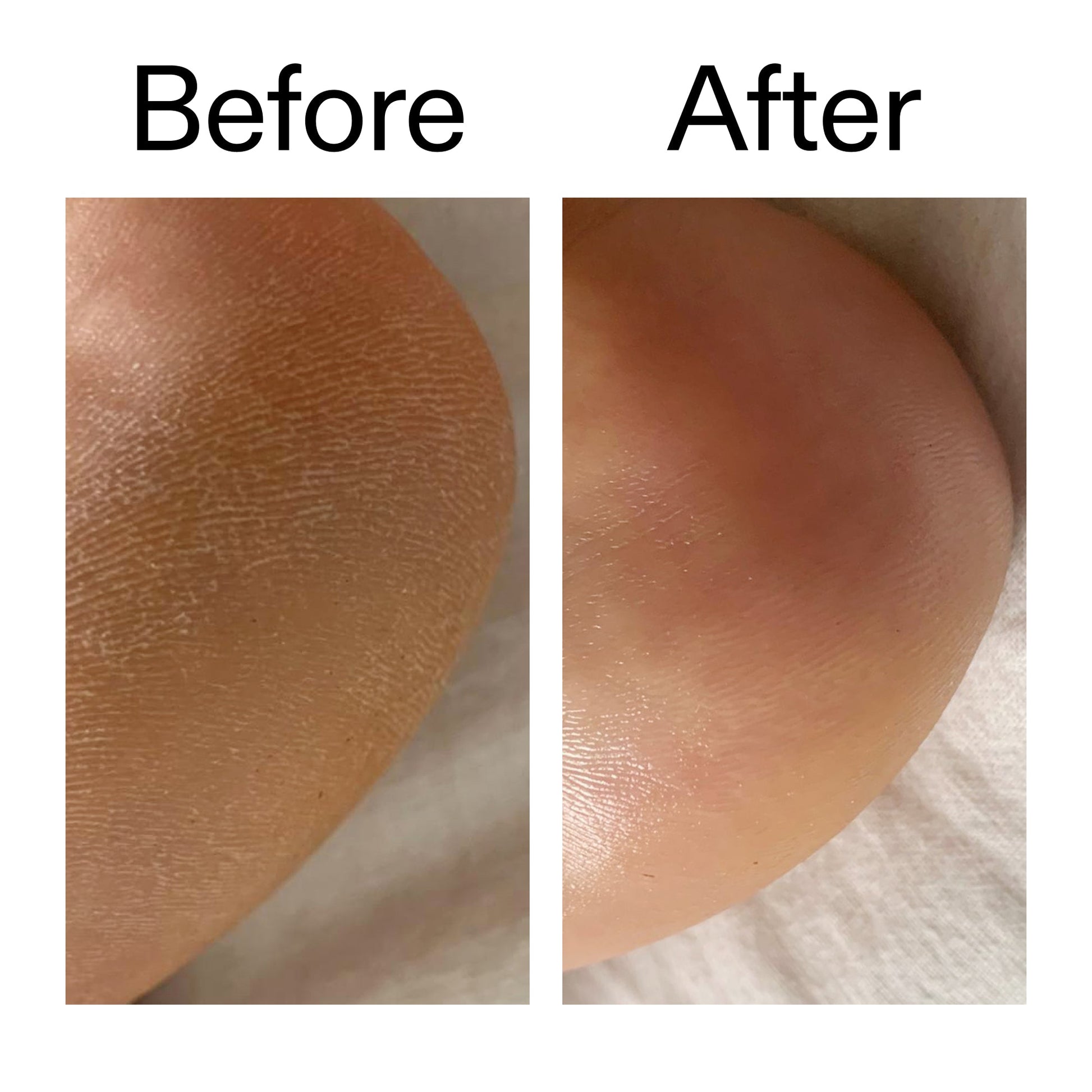 glycolic-acid-exfoliating-body-stick-o0 Glycolic_Acid_Exfoliating_Body_Stick_Before_After_V1_2000x2000_a3043625-9400-429a-a7fb-d6dbd220f722.jpg