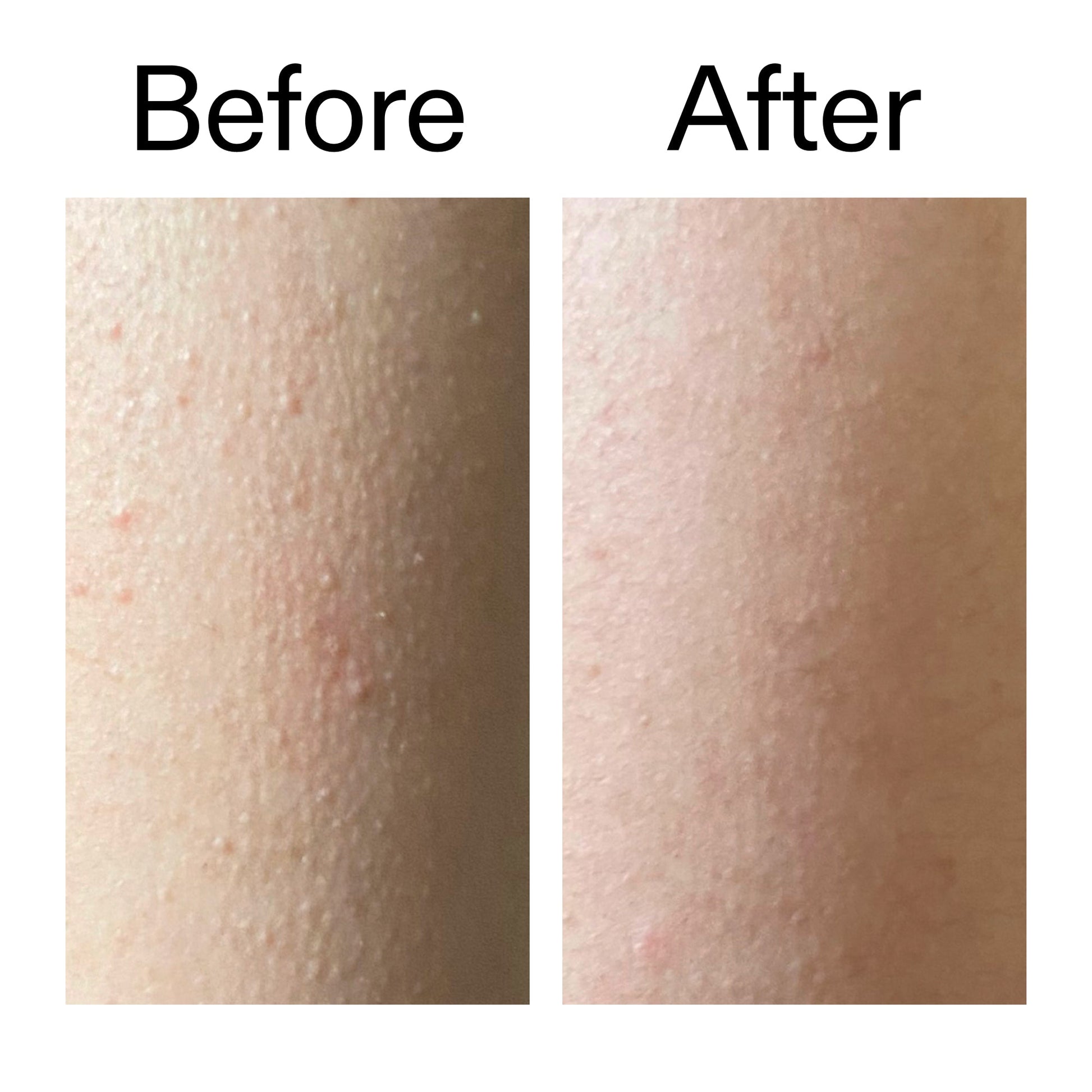 glycolic-acid-exfoliating-body-stick-duo-d6 Glycolic_Acid_Exfoliating_Body_Stick_Before_After_V2_2000x2000_2e4ba052-94f6-4d56-82df-7bdb5b2df7ae.jpg