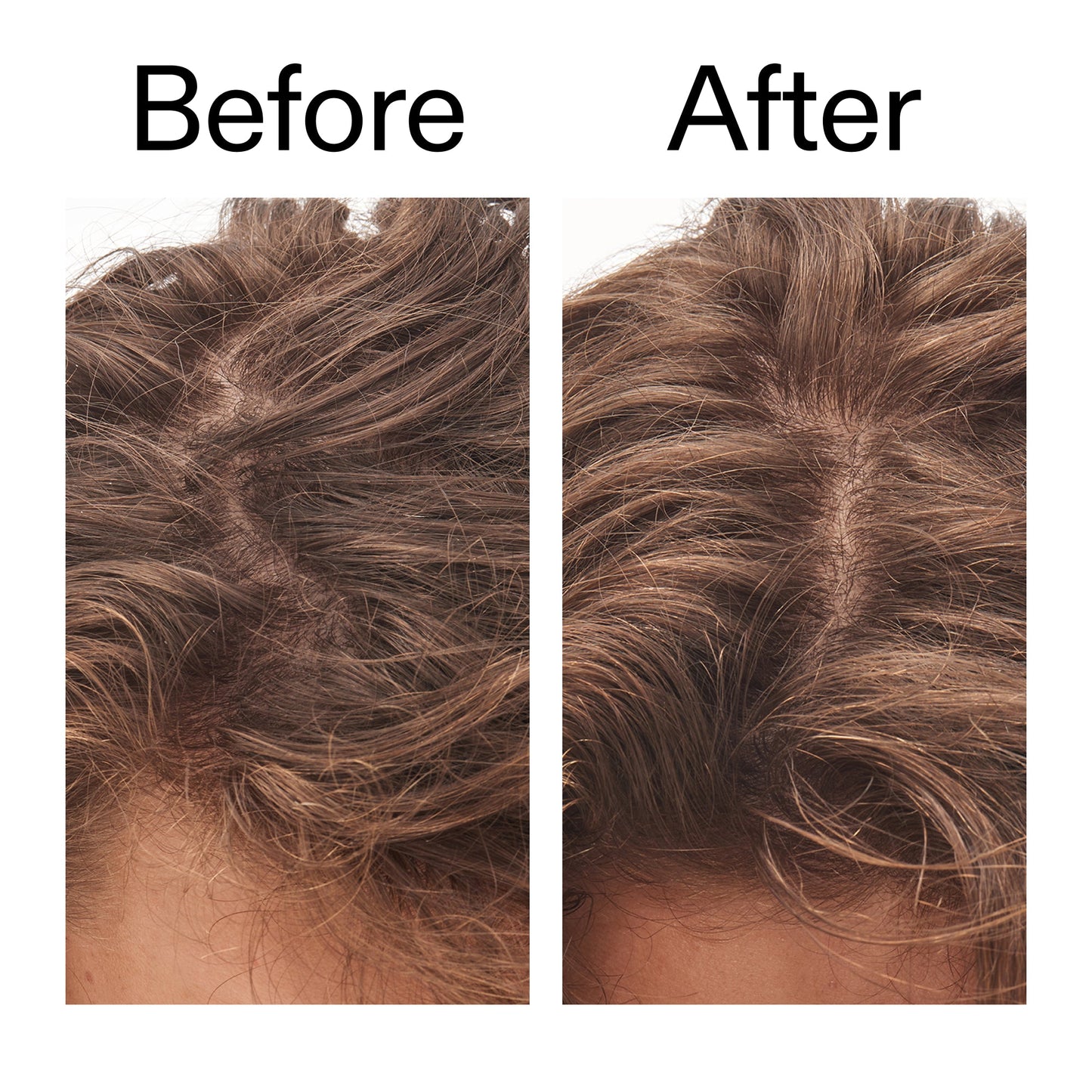 glycolic-acid-exfoliating-scalp-scrub-k9 Glycolic_Acid_Exfoliating_Scalp_Scrub_Before_After_2000x2000_b8561c87-05a1-4caa-80f7-1b6b33d750f7.jpg