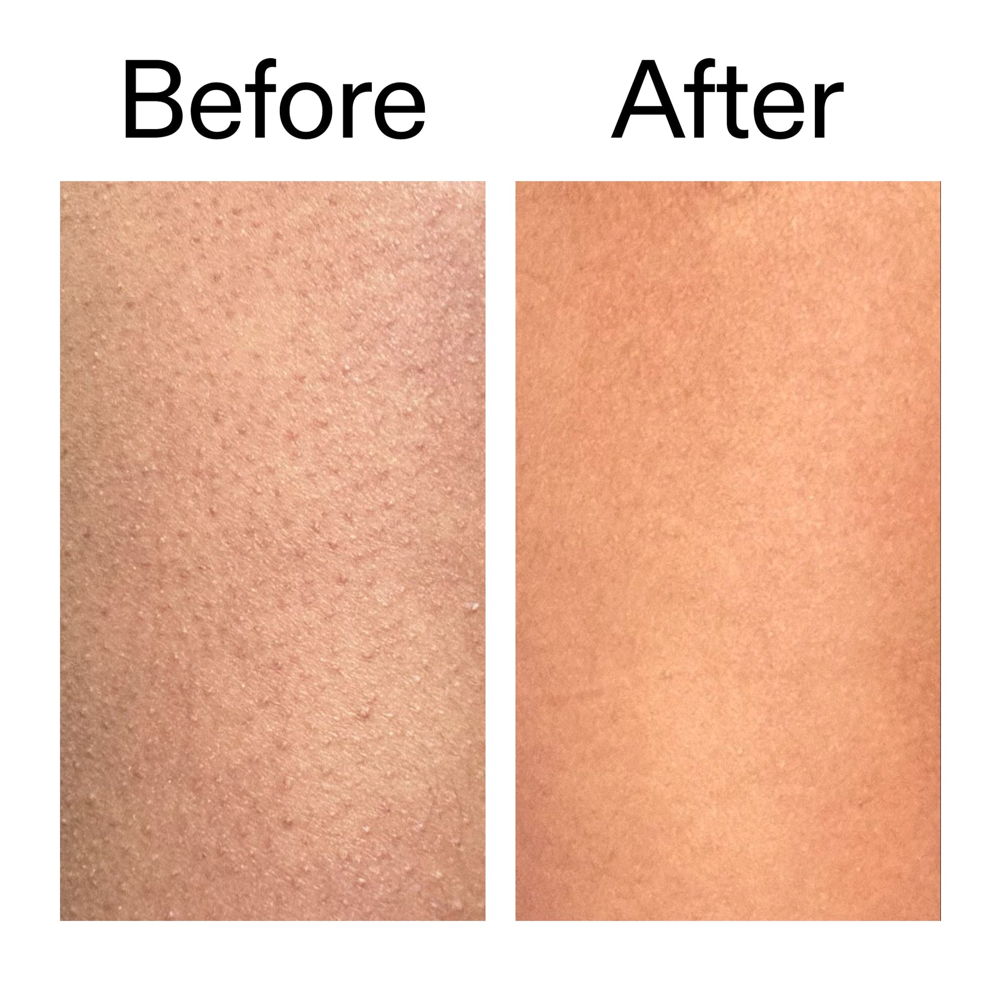 glycolic-acid-exfoliating-body-stick-duo-d6 Glycolic_Body_Stick_B_A_2000x2000_6e6e6b4d-5bd7-43c0-aeed-4d66788e8995.jpg