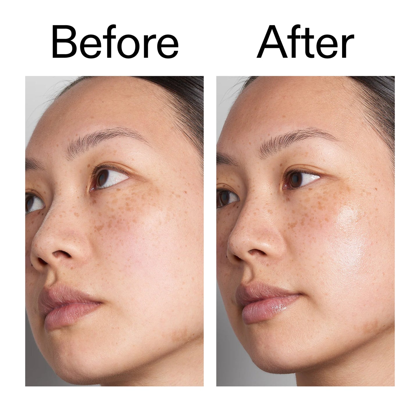 supersize-hyaluronic-acid-serum-100ml-duo-k1 Hyaluronic_Acid_Before_After_2000x2000_d7983956-8aa2-4ea3-8255-c63e8d4f892e.jpg