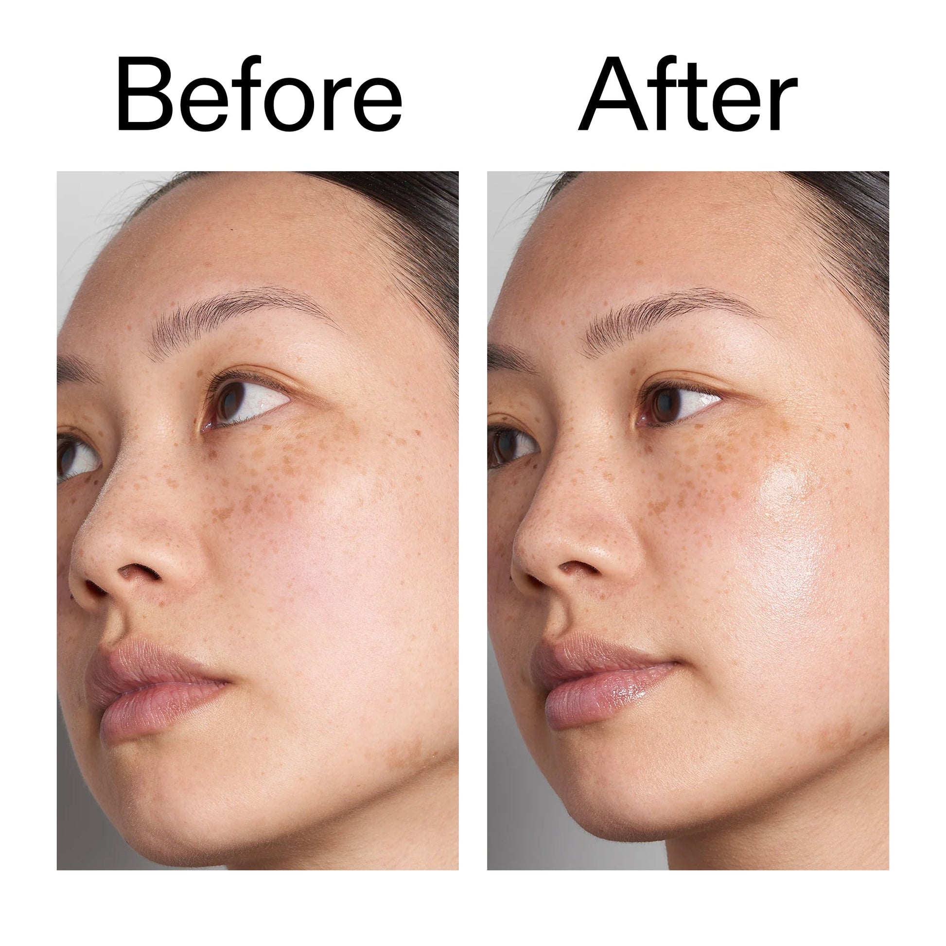 supersize-hyaluronic-acid-serum-100ml-duo-k1 Hyaluronic_Acid_Before_After_2000x2000_d7983956-8aa2-4ea3-8255-c63e8d4f892e.jpg