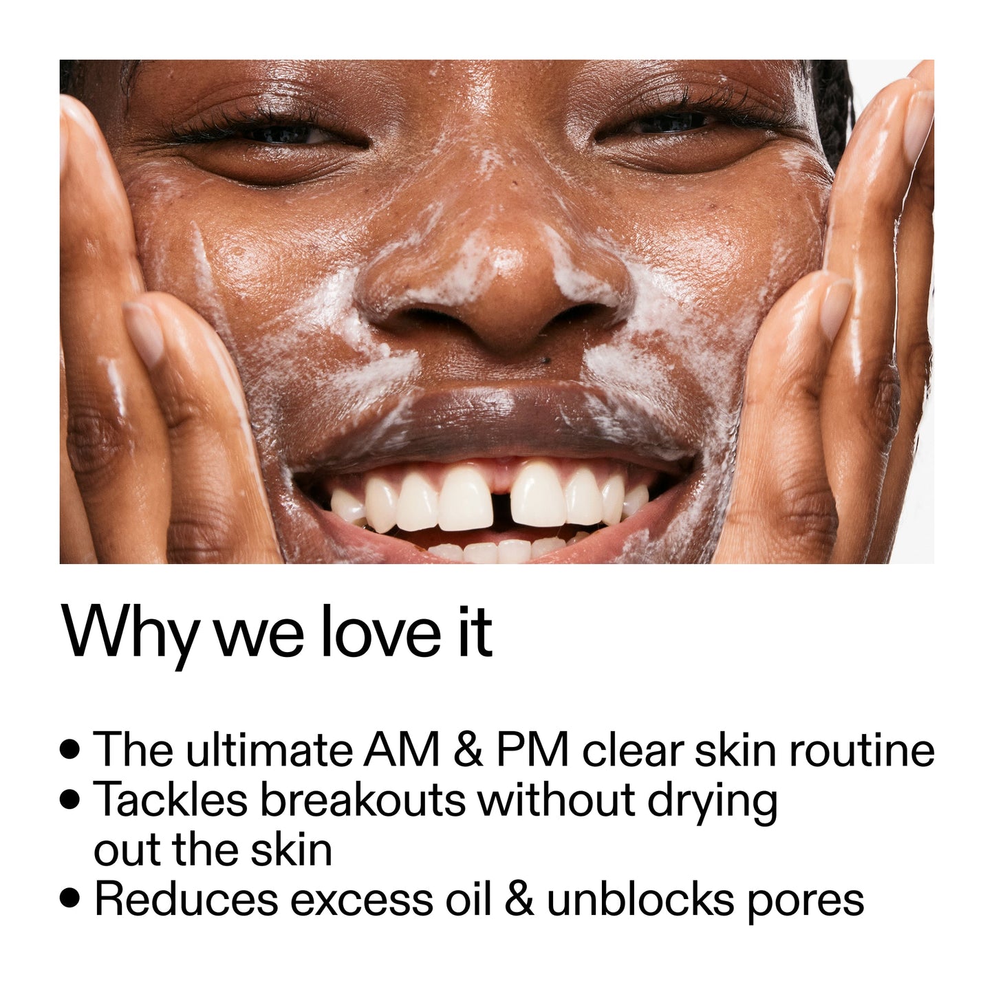 intro-routine-for-acne-v4 Intro_Routine_for_Acne_Why_we_love_it_2000x2000_42499e10-4629-4a0e-a627-7e215f4da6bc.jpg