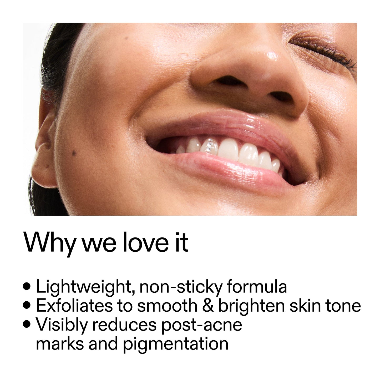 mandelic-acid-treatment-r7 Mandelic_Acid_Treatment_Why_we_love_it_2000x2000_6dfe29a9-2a79-464f-a5e8-e5ac37d93388.jpg
