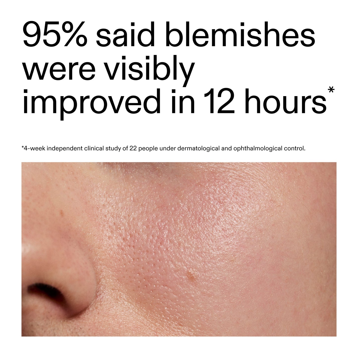 succinic-acid-acne-treatment-d3 Oat_Cleansing_Balm_Claim_2000x2000_ac6ce553-25db-41b2-a981-faae1ac4b8c0.jpg