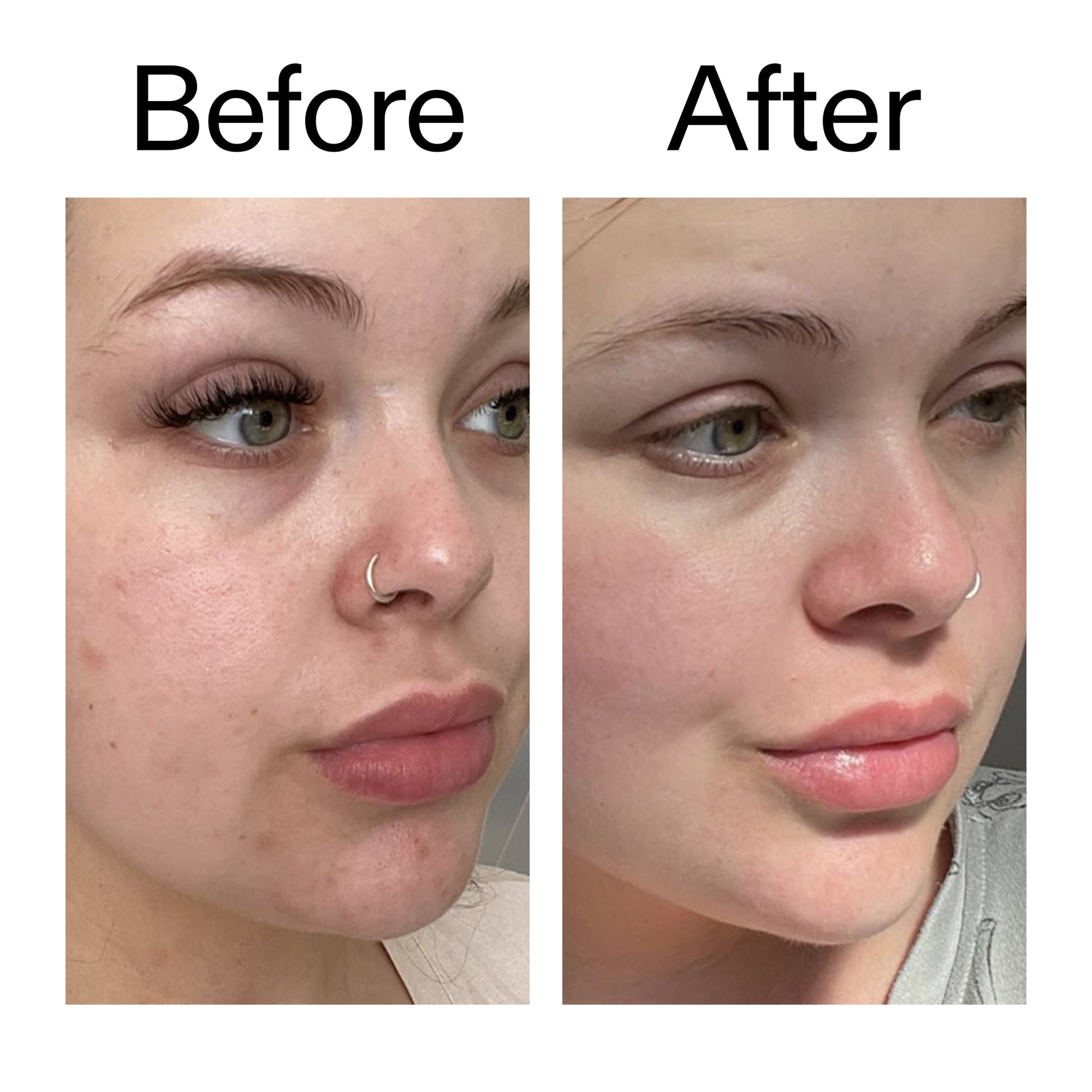 supersize-omega-water-cream-duo-u8 Omega50_Before_After_2000x2000_46483ed8-3f9d-487f-9a0c-9df79830bd65.jpg