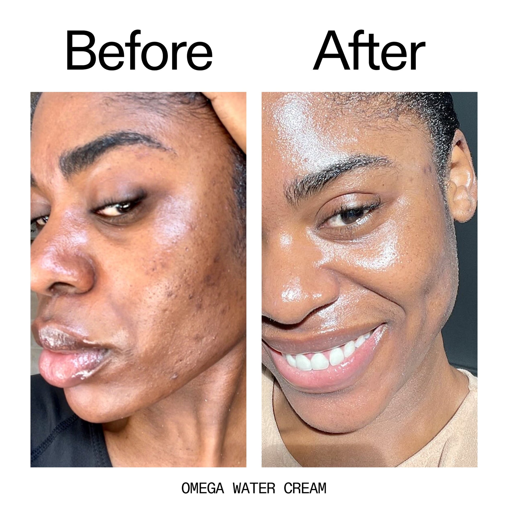 hydrating-cleanser-and-moisturizer-duo-p3 Omega_Water_Cream_Before_After_2000x2000_8e88278b-8c8d-48dc-ac77-4e98ebbd1b77.jpg