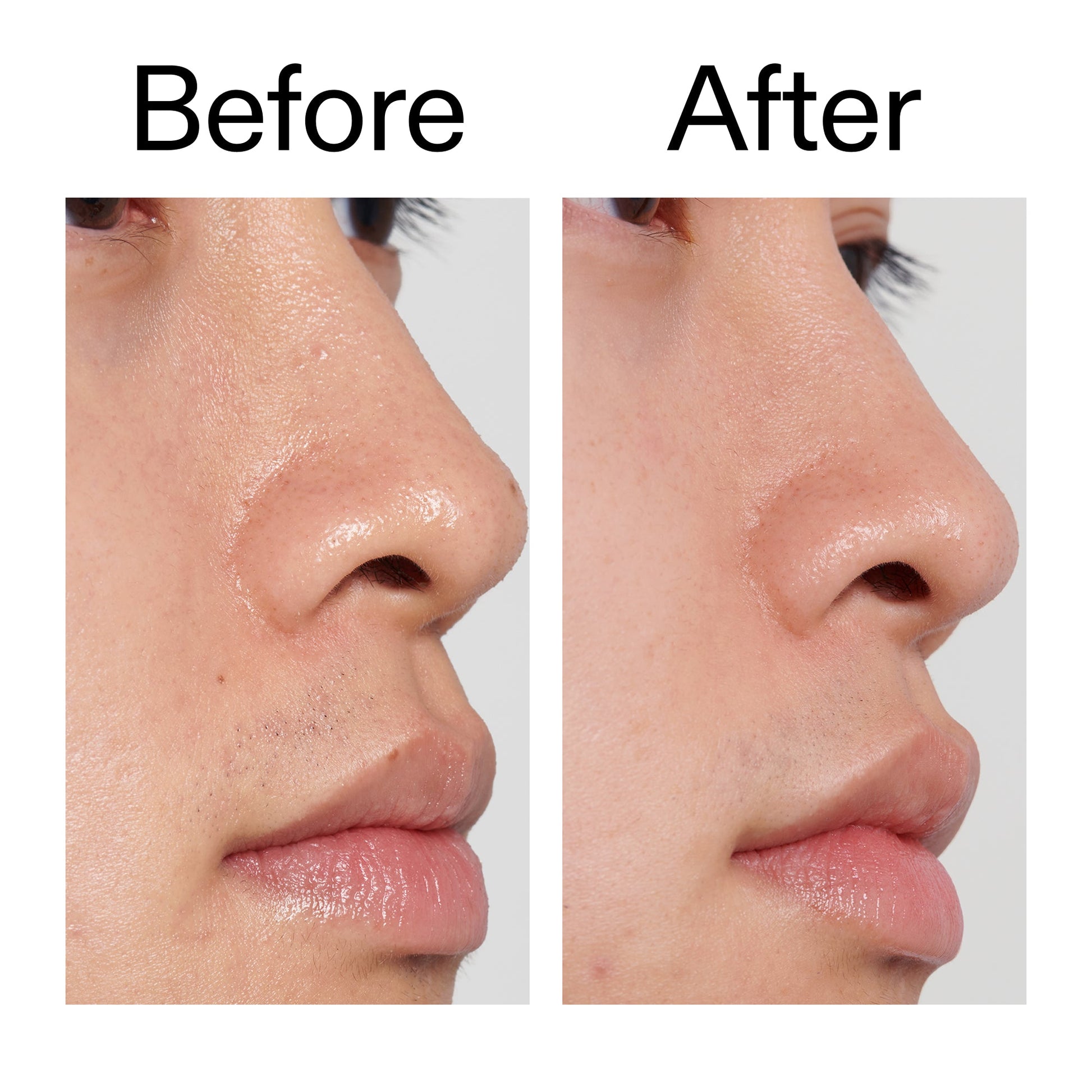 pha-toner-k2 PHA_Toner_Before_After_2000x2000_e3c10172-0150-4342-8b95-57417eaff50d.jpg