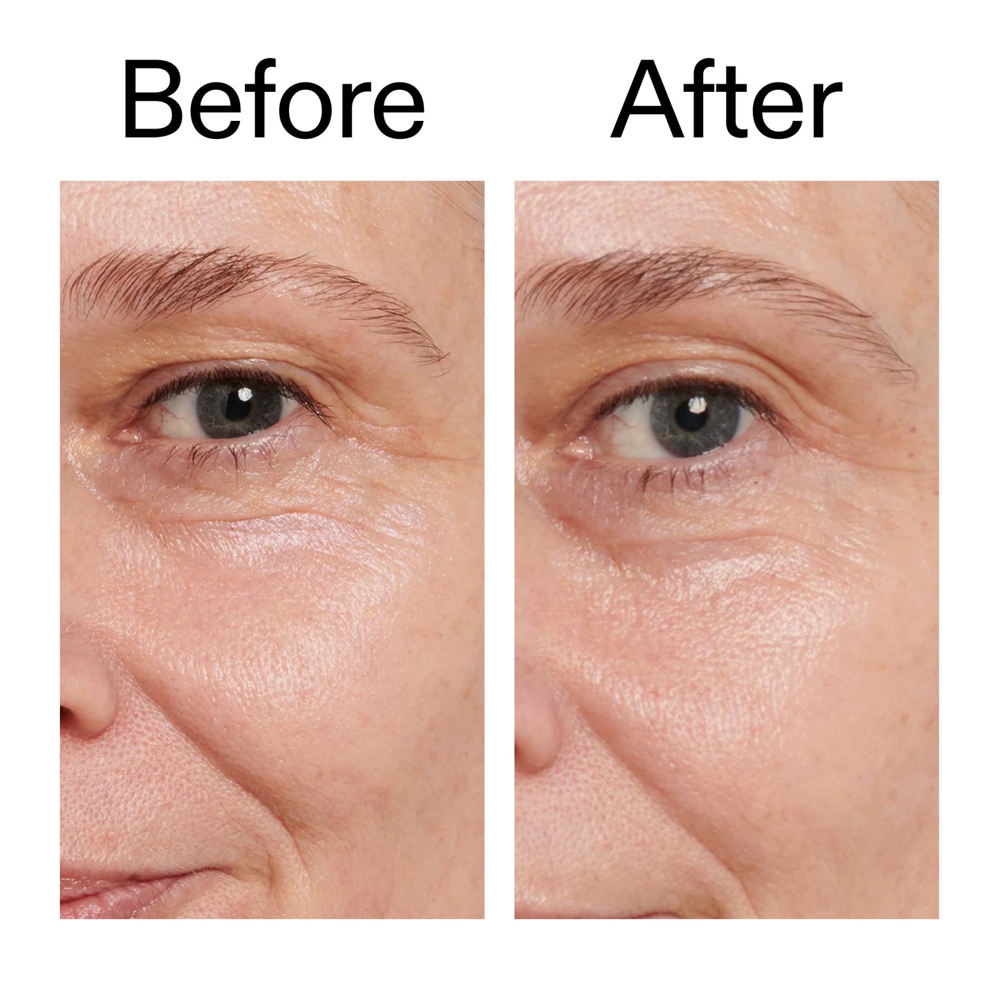 retinol-eye-cream-u7 Retinol_Eye_Cream_Before_After_2000x2000_ac03a80c-109e-4572-a95a-91dc109b4d27.jpg