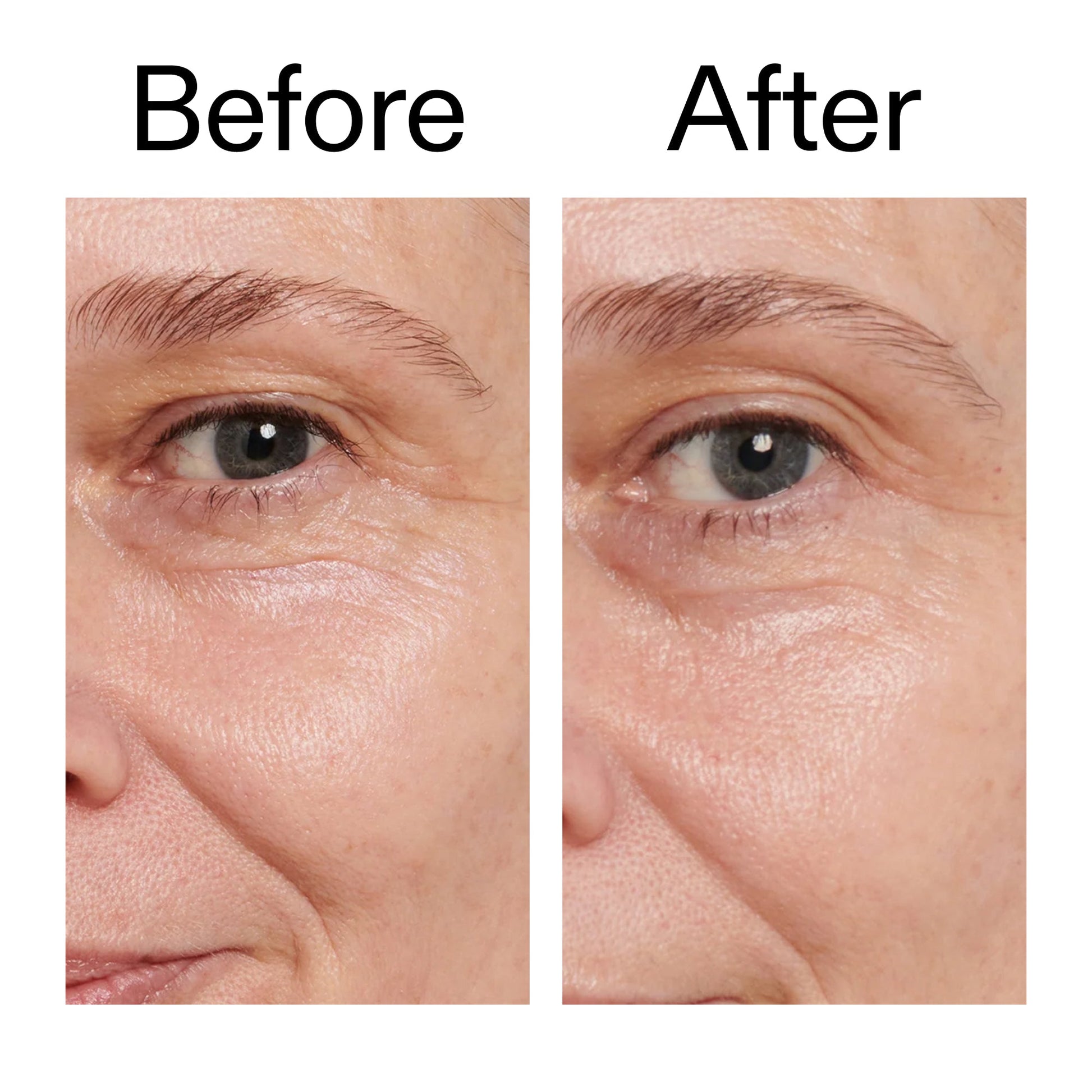 retinol-eye-cream-u7 Retinol_Eye_Cream_Before_After_2000x2000_ac03a80c-109e-4572-a95a-91dc109b4d27.jpg