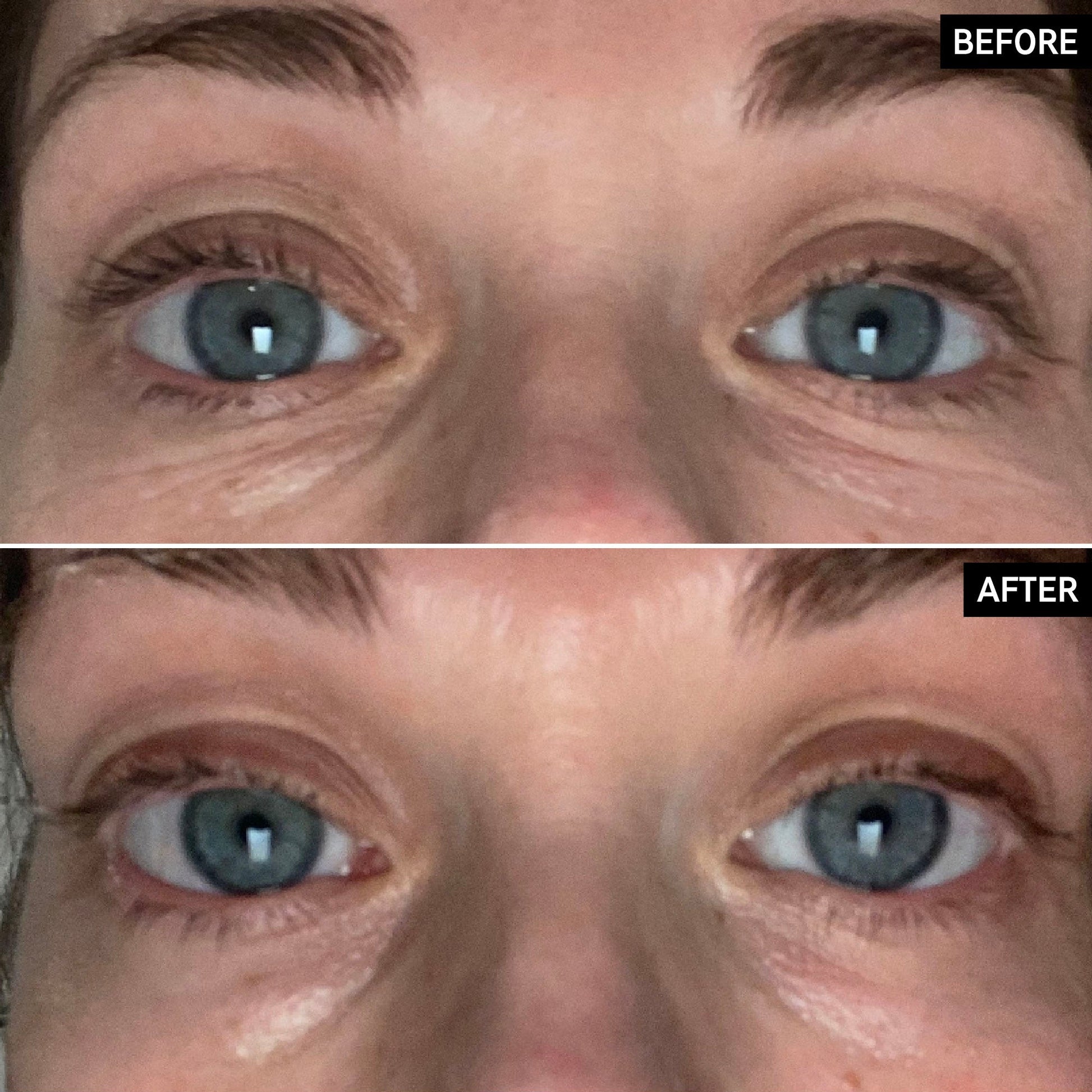 retinol-eye-cream-u7 SITE-UGCBAsApril_Nicole_B_A_PPage_2000x2000_1.jpg