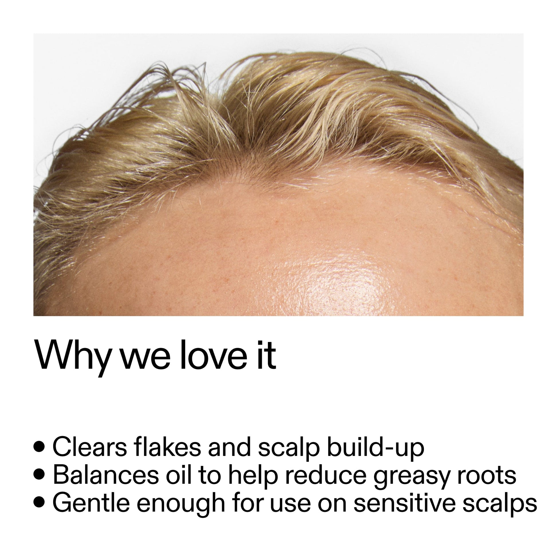 salicylic-acid-exfoliating-scalp-treatment-e5 Salicylic_Acid_Exfoliating_Scalp_Treatment_Why_we_love_it_2000x2000_44b6bd6d-9ec4-4b23-9dc4-bc3fd6f28e14.jpg