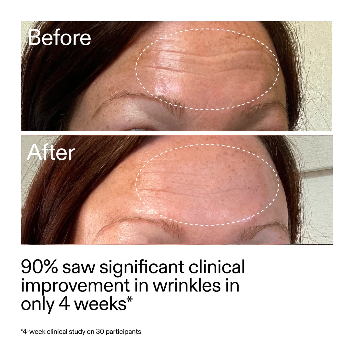 starter-retinol-serum-d7 StarterRetinol_BeforeAfter_Claim1_2000x2000_a09b50b6-4688-4527-abae-21bd142b89b7.jpg