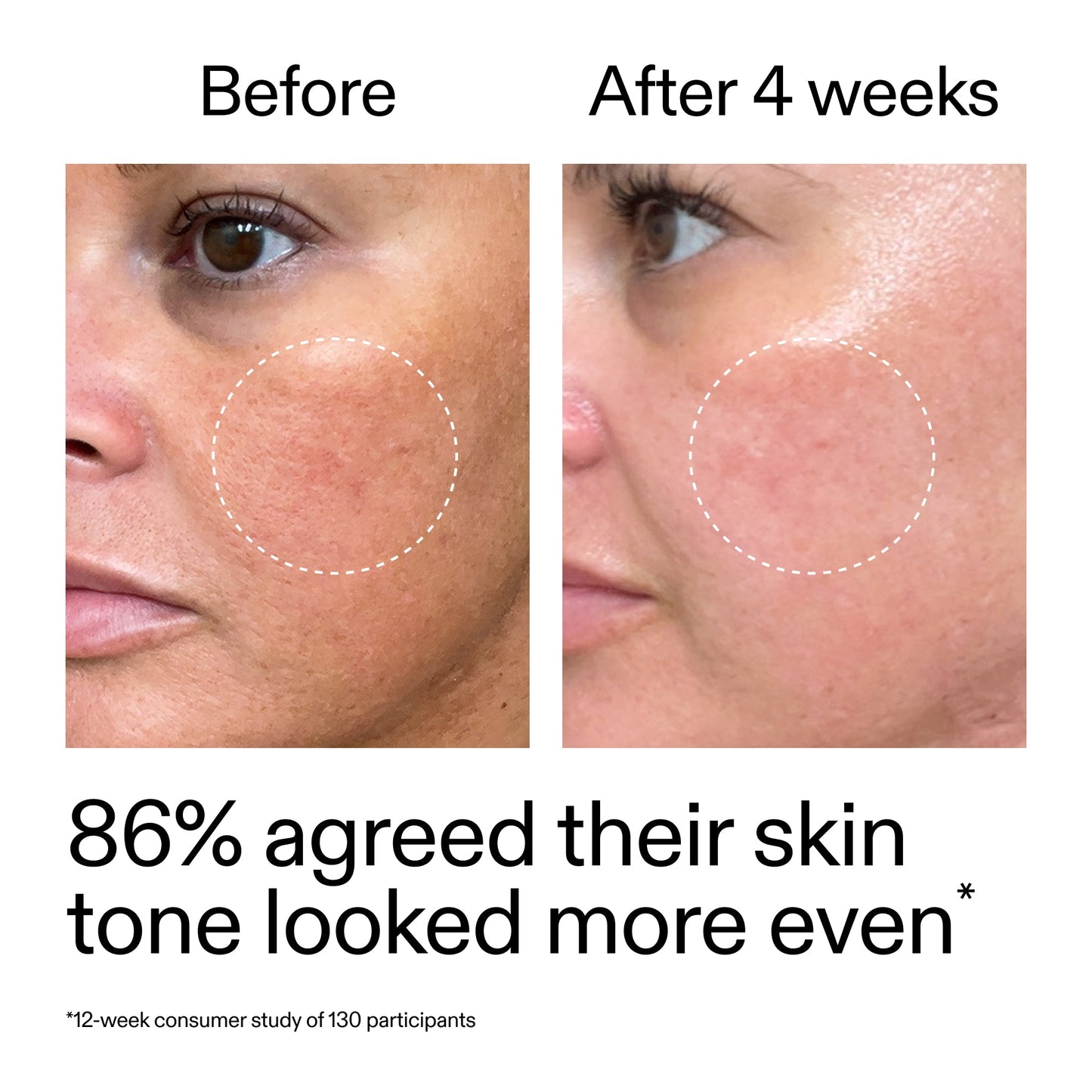starter-retinol-serum-d7 StarterRetinol_BeforeAfter_Claim2_2000x2000_f5c9ecc0-8d76-429d-bef5-c3a61bcf5c09.jpg