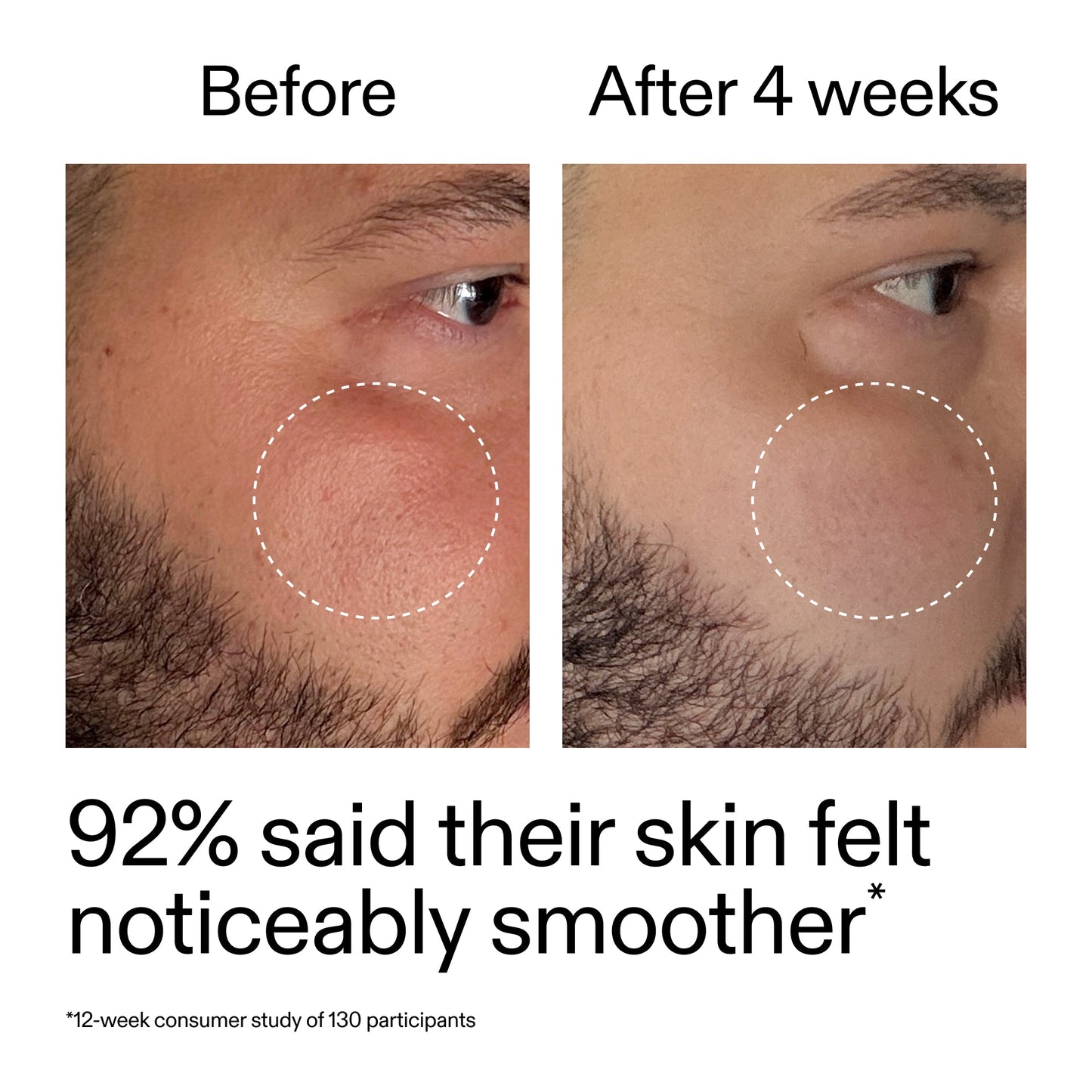 starter-retinol-serum-d7 StarterRetinol_BeforeAfter_Claim3_2000x2000_6ceab106-e0ee-4ed4-ba62-41bc39538038.jpg