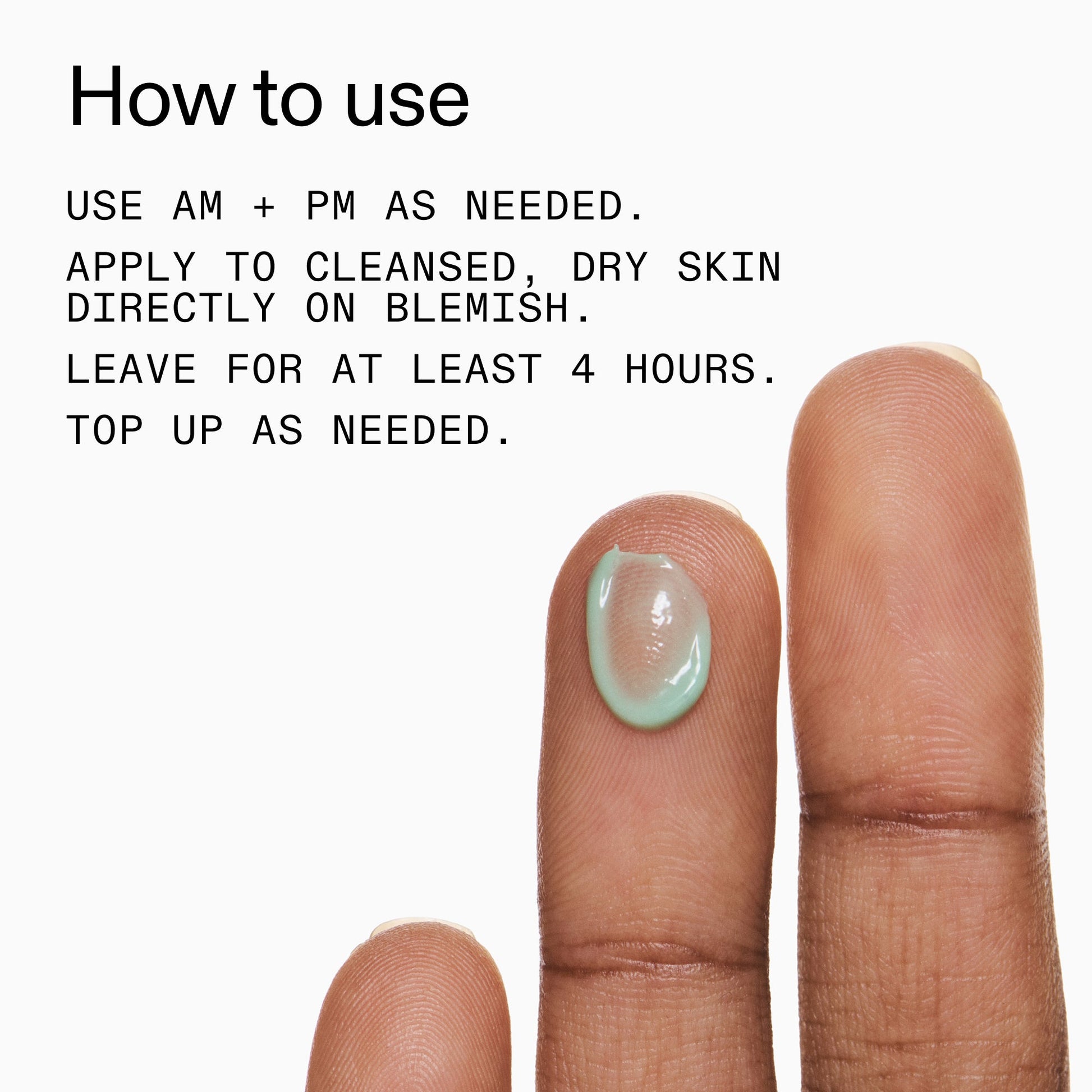 succinic-acid-acne-treatment-d3 Succinic_Acid_Treatment_How_to_Use_2000x2000_d57137d5-d7f1-427c-9a46-5fc00c19c542.jpg