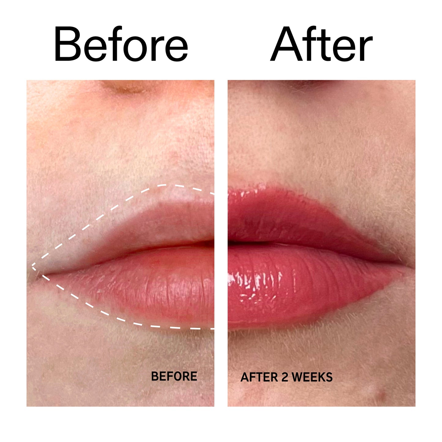 tripeptide-plumping-berry-lip-balm-b0 Tripeptide_Plumping_Lip_Balm_-_Berry_Before_After_2000x2000_9474bbd8-43ca-4b0e-b0e7-dfab70b91927.jpg