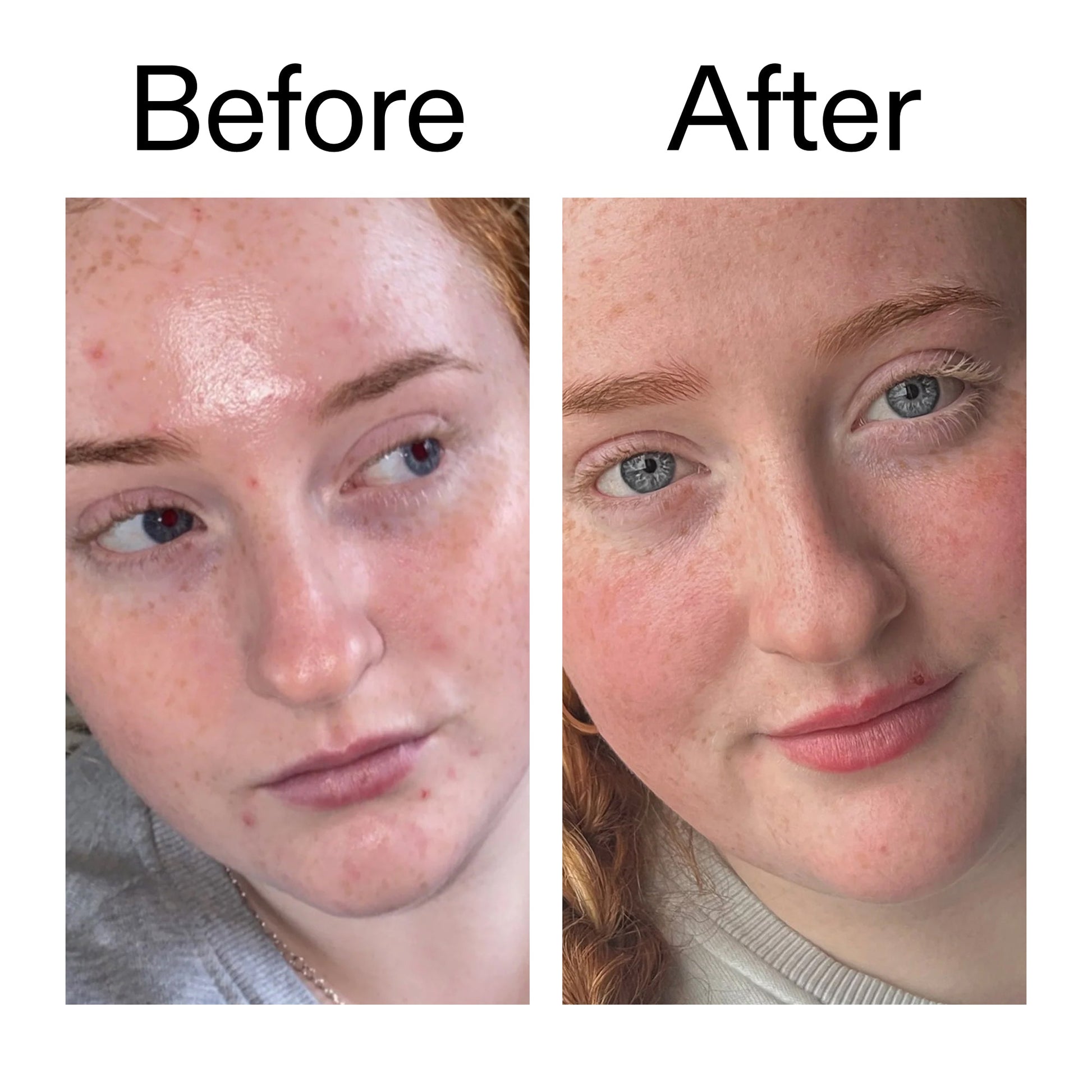 vitamin-b-c-and-e-moisturizer-f4 Vitamin_B_C_and_E_Moisturizer_Before_After_2000x2000_b0781a76-5ad2-4be9-95b8-ef92b356833c.jpg
